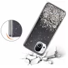 Luxury Bling Glitter Case For Xiaomi 2